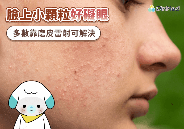 臉上小顆粒_封面